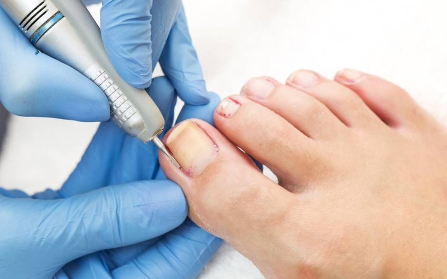 Best Ingrown Nail Scissors: Expert Recommendations for New York