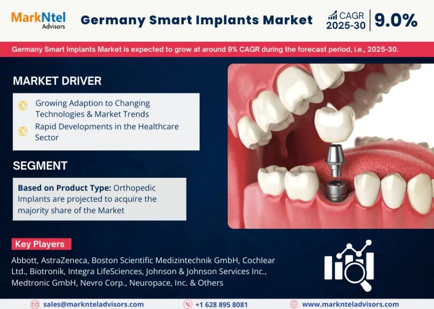 Germany Smart Implants Industry Overview: Size, Value, and Forecast Outlook 2030