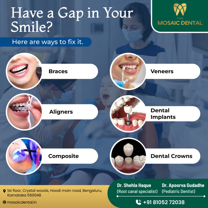 Smile Brighter: Discover the Best Dental Clinic in Hoodi for Complete Oral Care