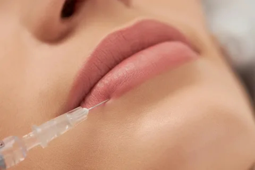 Beginner’s Guide to Lip Filler in Novi