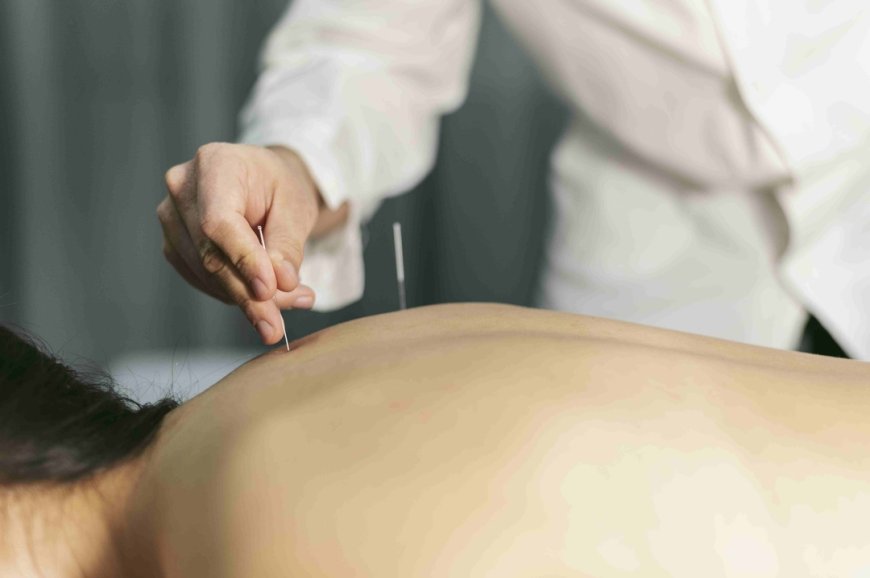 The Benefits of Regular Acupuncture for Long-Term Digestive Health