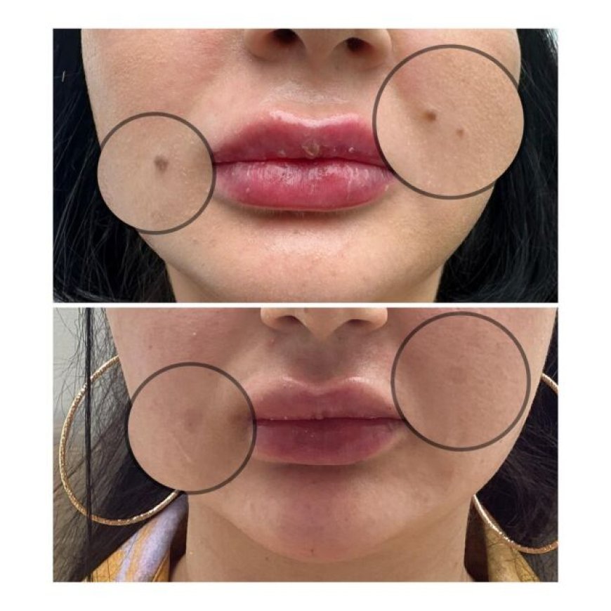 Your Best Skin Why a Richmond Skin Clinic is Your Go-To