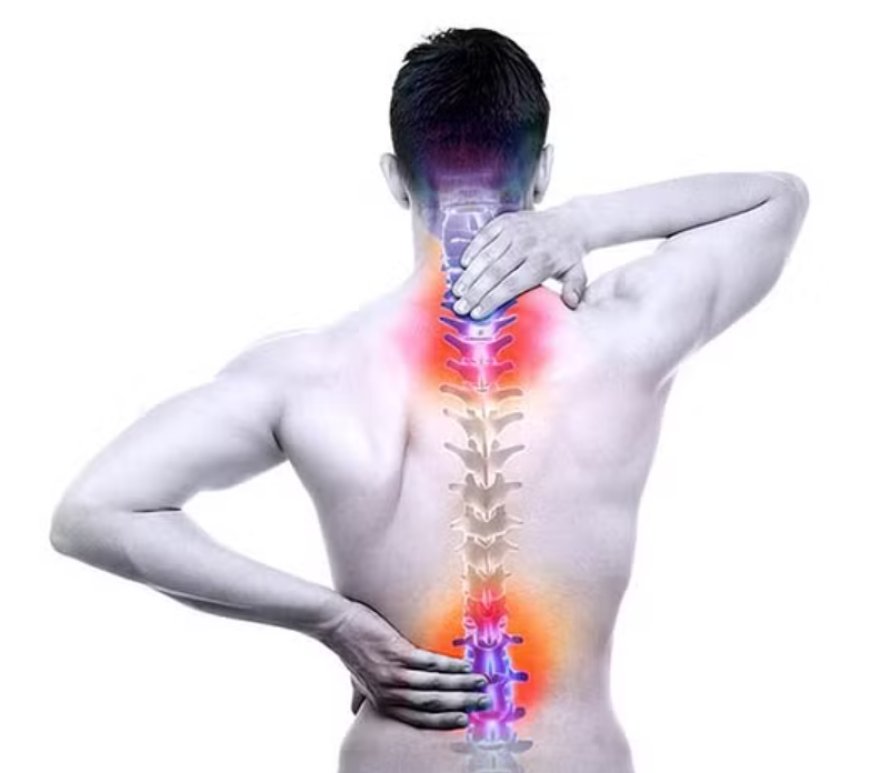 ACDF surgery
