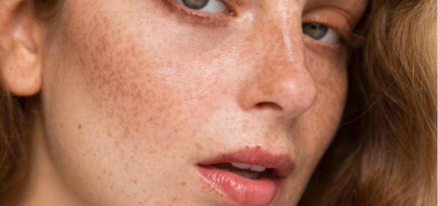 pigmentation treatments singapore