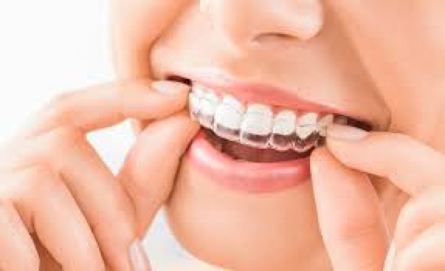 What Age Is Best for Invisalign? Advice from a Lake Mary Dentist
