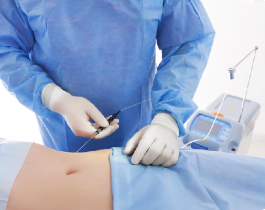 Top Qualities to Look for in the Best Liposuction Surgeon in Hyderabad
